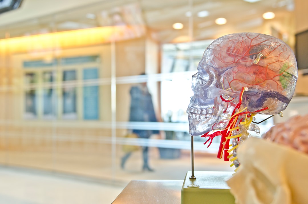 Diagram showing stress effects on the cardiovascular system